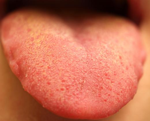 During the early days of professional baseball, it was not uncommon for pitchers to apply saliva to the surface of a baseball.